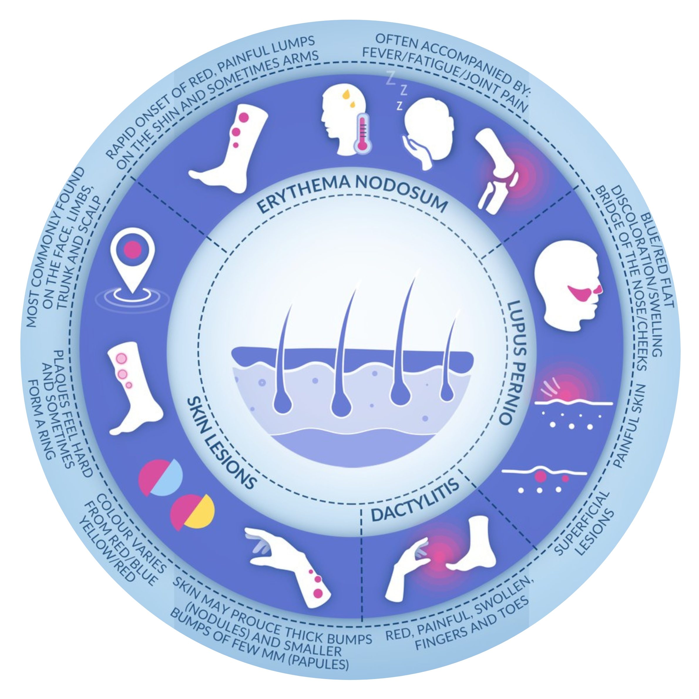 Untitled design (3) Sarcoidosis and the Skin infographic